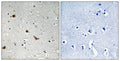 Immunohistochemical analysis of paraffin-embedded human brain tissue using IKK-γ (Phospho-Ser376) antibody (left)or the same antibody preincubated with blocking peptide (right).