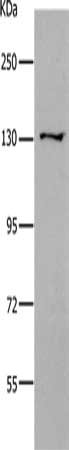 Gel: 10%SDS-PAGE, Lysate: 40 ug, Lane: Human brain malignant glioma tissue, Primary antibody: CSB-PA553061(CDH2 Antibody) at dilution 1/450, Secondary antibody: Goat anti rabbit IgG at 1/8000 dilution, Exposure time: 2 minutes