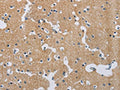 The image on the left is immunohistochemistry of paraffin-embedded Human brain tissue using CSB-PA553180(SYN2 Antibody) at dilution 1/40, on the right is treated with synthetic peptide. (Original magnification: ×200)
