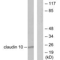 Western blot analysis of extracts from LOVO cells, using Claudin 10 antibody.