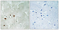 Immunohistochemical analysis of paraffin-embedded human brain tissue using Tip60 (Phospho-Ser90) antibody (left)or the same antibody preincubated with blocking peptide (right).