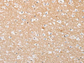 ATG9A Antibody – Figure 1 of 3