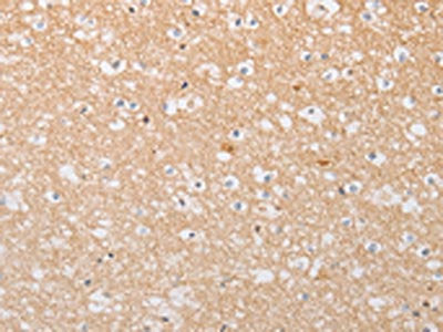 ATG9A Antibody – Figure 1 of 3