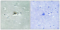 Immunohistochemical analysis of paraffin-embedded human brain tissue using Claudin 5 (Phospho-Tyr217) antibody (left)or the same antibody preincubated with blocking peptide (right).