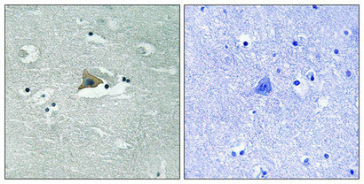 Immunohistochemical analysis of paraffin-embedded human brain tissue using Claudin 5 (Phospho-Tyr217) antibody (left)or the same antibody preincubated with blocking peptide (right).