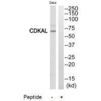 Western blot analysis of extracts from COLO205 cells, using CDKAL antibody.