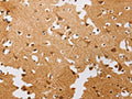 The image on the left is immunohistochemistry of paraffin-embedded Human brain tissue using CSB-PA555140(ATG4C Antibody) at dilution 1/20, on the right is treated with fusion protein. (Original magnification: ×200)