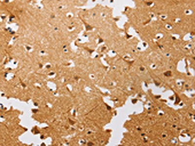The image on the left is immunohistochemistry of paraffin-embedded Human brain tissue using CSB-PA555140(ATG4C Antibody) at dilution 1/20, on the right is treated with fusion protein. (Original magnification: ×200)