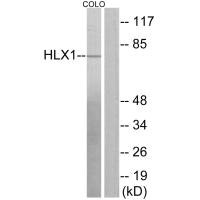 Western blot analysis of extracts from COLO205 cells, using HLX1 antibody.