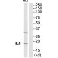 Western blot analysis of extracts from HeLa cells, using IL4 antibody.