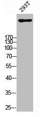 Western blot analysis of 293T using IP3R-I antibody. Antibody was diluted at 1:500. Secondary antibody  was diluted at 1:20000