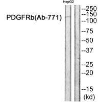Western blot analysis of extracts from HepG2 cells, using PDGFRb (Ab-771) antibody.