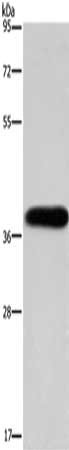 Gel: 8%SDS-PAGE, Lysate: 40 ug, Lane: HepG2 cells, Primary antibody: CSB-PA556975(PITX2 Antibody) at dilution 1/200, Secondary antibody: Goat anti rabbit IgG at 1/8000 dilution, Exposure time: 40 seconds