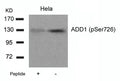 Western blot analysis of extracts from Hela cells using ADD1(Phospho-Ser726) Antibody and the same antibody preincubated with blocking peptide.