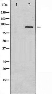 Western blot analysis of PKC alpha expression in UV treated NIH-3T3 whole cell lysates,The lane on the left is treated with the antigen-specific peptide.