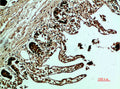 Immunohistochemical analysis of paraffin-embedded human-colon, antibody was diluted at 1:200