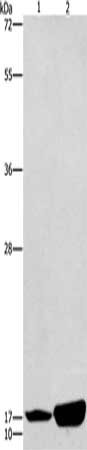 Gel: 12%SDS-PAGE, Lysate: 50 ug, Lane 1-2: Human fetal liver tissue, mouse pancreas tissue, Primary antibody: CSB-PA558678(ARTN Antibody) at dilution 1/300, Secondary antibody: Goat anti rabbit IgG at 1/8000 dilution, Exposure time: 1 minute