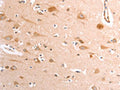 The image on the left is immunohistochemistry of paraffin-embedded Human brain tissue using CSB-PA558953(TRPV4 Antibody) at dilution 1/40, on the right is treated with fusion protein. (Original magnification: ×200)