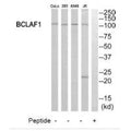 Western blot analysis of extracts from 293 cells, Jurkat cells and A549 cells, using BCLAF1 antibody.