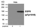 Western blot analysis of extracts from Hela cells using EGFR (Phospho-Tyr1016) Antibody.The lane on the left is treated with the antigen-specific peptide.