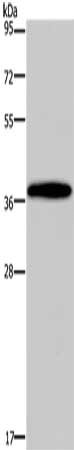 Gel: 10%SDS-PAGE, Lysate: 40 ug, Lane: Mouse brain tissue, Primary antibody: CSB-PA559863(DLX4 Antibody) at dilution 1/900, Secondary antibody: Goat anti rabbit IgG at 1/8000 dilution, Exposure time: 5 seconds