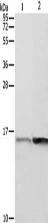Gel: 12%SDS-PAGE, Lysate: 40 ug, Lane 1-2: Jurkat cells, 231 cells, Primary antibody: CSB-PA560586(PFN1 Antibody) at dilution 1/350, Secondary antibody: Goat anti rabbit IgG at 1/8000 dilution, Exposure time: 10 seconds