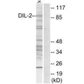 Western blot analysis of extracts from Jurkat cells, using DIL-2 antibody.