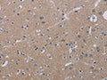 The image on the left is immunohistochemistry of paraffin-embedded Human brain tissue using CSB-PA561716(KLHL2 Antibody) at dilution 1/20, on the right is treated with fusion protein. (Original magnification: ×200)