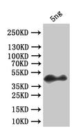 Western Blot
Positive WB detected in: recombinant protein
All lanes:forkhead box protein O Antibody at 1:1000
Secondary
Goat polyclonal to rabbit IgG at 1/50000 dilution
Predicted band size: 35.6 kDa
Observed band size: 42 kDa