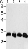 Gel: 10%SDS-PAGE, Lysate: 40 ug, Lane 1-4: Hela cells, A549 cells, human liver cancer tissue, lncap cells, Primary antibody: CSB-PA562484(PTGES2 Antibody) at dilution 1/550, Secondary antibody: Goat anti rabbit IgG at 1/8000 dilution, Exposure time: 20 seconds