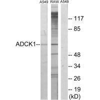 Western blot analysis of extracts from A549 cells and RAW264.7 cells, using ADCK1 antibody.