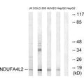 Western blot analysis of extracts from Jurkat cells, COLO cells, HUVEC cells and HepG2 cells, using NDUFA4L2 antibody.