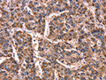 The image on the left is immunohistochemistry of paraffin-embedded Human liver cancer tissue using CSB-PA563307(GCG Antibody) at dilution 1/15, on the right is treated with synthetic peptide. (Original magnification: ×200)