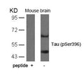Western blot analysis of extracts from mouse brain tissue using Tau(Phospho-Ser396) Antibody and the same antibody preincubated with blocking peptide.