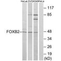 Western blot analysis of extracts from HeLa cells, LOVO cells and A549 cells, using FOXB2 antibody.