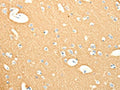 The image on the left is immunohistochemistry of paraffin-embedded Human brain tissue using CSB-PA564264(SNAP25 Antibody) at dilution 1/25, on the right is treated with fusion protein. (Original magnification: ×200)