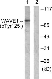 Western blot analysis of extracts from NIH/3T3 cells, treated with Insulin (0.01U/ml, 15mins), using WAVE1 (Phospho-Tyr125) antibody. The lane on the right is treated with the synthesized peptide.