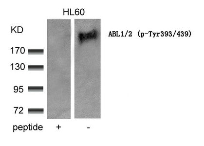 Western blot analysis of extracts from HL60 cells using ABL1/2(phospho-Tyr393/439) Antibody and the same antibody preincubated with blocking peptide.
