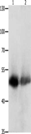 Gel: 10%SDS-PAGE, Lysate: 60 ug, Lane 1-2: Human bladder carcinoma tissue, Human liver cancer tissue, Primary antibody: CSB-PA566314(CEACAM1 Antibody) at dilution 1/300, Secondary antibody: Goat anti rabbit IgG at 1/8000 dilution, Exposure time: 30 minutes