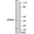 Western blot analysis of extracts from K562 cells, using CREM antibody.