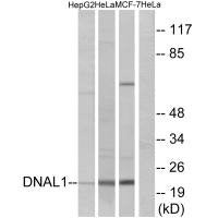 Western blot analysis of extracts from HepG2 cells, HeLa cells and MCF-7cells, using DNAL1 antibody.