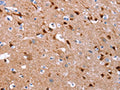 The image on the left is immunohistochemistry of paraffin-embedded Human brain tissue using CSB-PA569512(GCGR Antibody) at dilution 1/25, on the right is treated with synthetic peptide. (Original magnification: ×200)