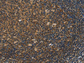 The image on the left is immunohistochemistry of paraffin-embedded Human tonsil tissue using CSB-PA570795(IRF9 Antibody) at dilution 1/50, on the right is treated with fusion protein. (Original magnification: ×200)