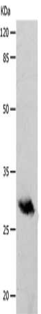 Gel: 10%SDS-PAGE, Lysate: 40 ug, Lane: Human fetal brain tissue, Primary antibody: CSB-PA570837(POMC(Alpha-MSH) Antibody) at dilution 1/400, Secondary antibody: Goat anti rabbit IgG at 1/8000 dilution, Exposure time: 10 seconds