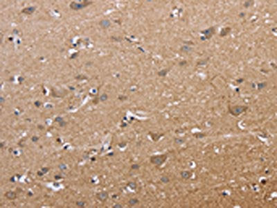 The image on the left is immunohistochemistry of paraffin-embedded Human brain tissue using CSB-PA571087(ECE1 Antibody) at dilution 1/50, on the right is treated with fusion protein. (Original magnification: ×200)