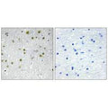 Immunohistochemistry analysis of paraffin-embedded human brain tissue, using NRIP2 antibody.