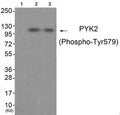 Western blot analysis of extracts from 3T3 cells (Lane 2) and HepG2 cells (Lane 3), using PYK2 (Phospho-Tyr579) Antibody. The lane on the left is treated with antigen-specific peptide.