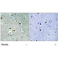 Immunohistochemistry analysis of paraffin-embedded human brain tissue using 53BP1 antibody.