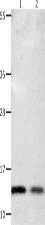 Gel: 10+12%SDS-PAGE, Lysate: 40 ug, Lane 1-2: Mouse heart tissue, human liver cancer tissue, Primary antibody: CSB-PA573665(COX5B Antibody) at dilution 1/350, Secondary antibody: Goat anti rabbit IgG at 1/8000 dilution, Exposure time: 40 seconds