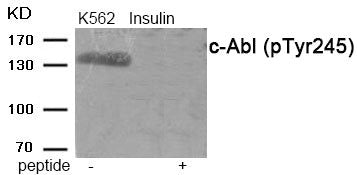 Western blot analysis of extracts from c-Abl  Insulin treated K562 tissue using antibody.The lane on the right is treated with the antigen-specific peptide.